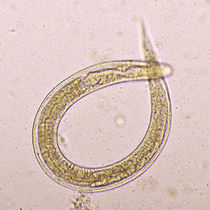 A close up of a curled Strongyloides under a microscope